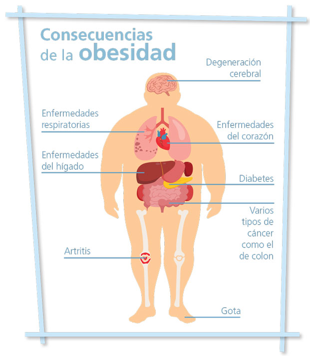 La ejercitación física una obligación irrenunciable en la educación